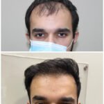 WhatsApp Image 2024-05-20 at 3.03.55 PM (1)